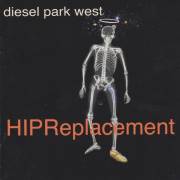 DIESEL PARK WEST - HIP REPLACEMENT - SHAKESPEARE ALABAMA DEMOS