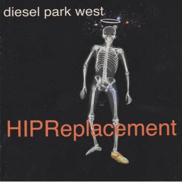 DIESEL PARK WEST - HIP REPLACEMENT - SHAKESPEARE ALABAMA DEMOS
